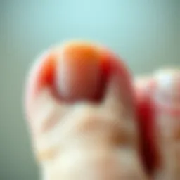 Close-up of toenail showing keratin buildup