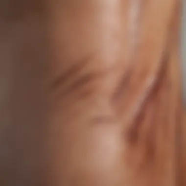 Effects of Chiropractic Scraping on Skin Close-up of skin with markings post-scraping treatment