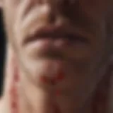 Red rash indicating fungal infection