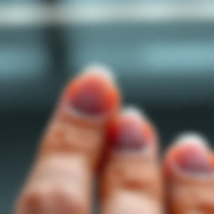 Understanding the Blackening of Nails: Causes, Implications, and Management Summary Understanding the Blackening of Nails: Causes, Implications, and Management Summary